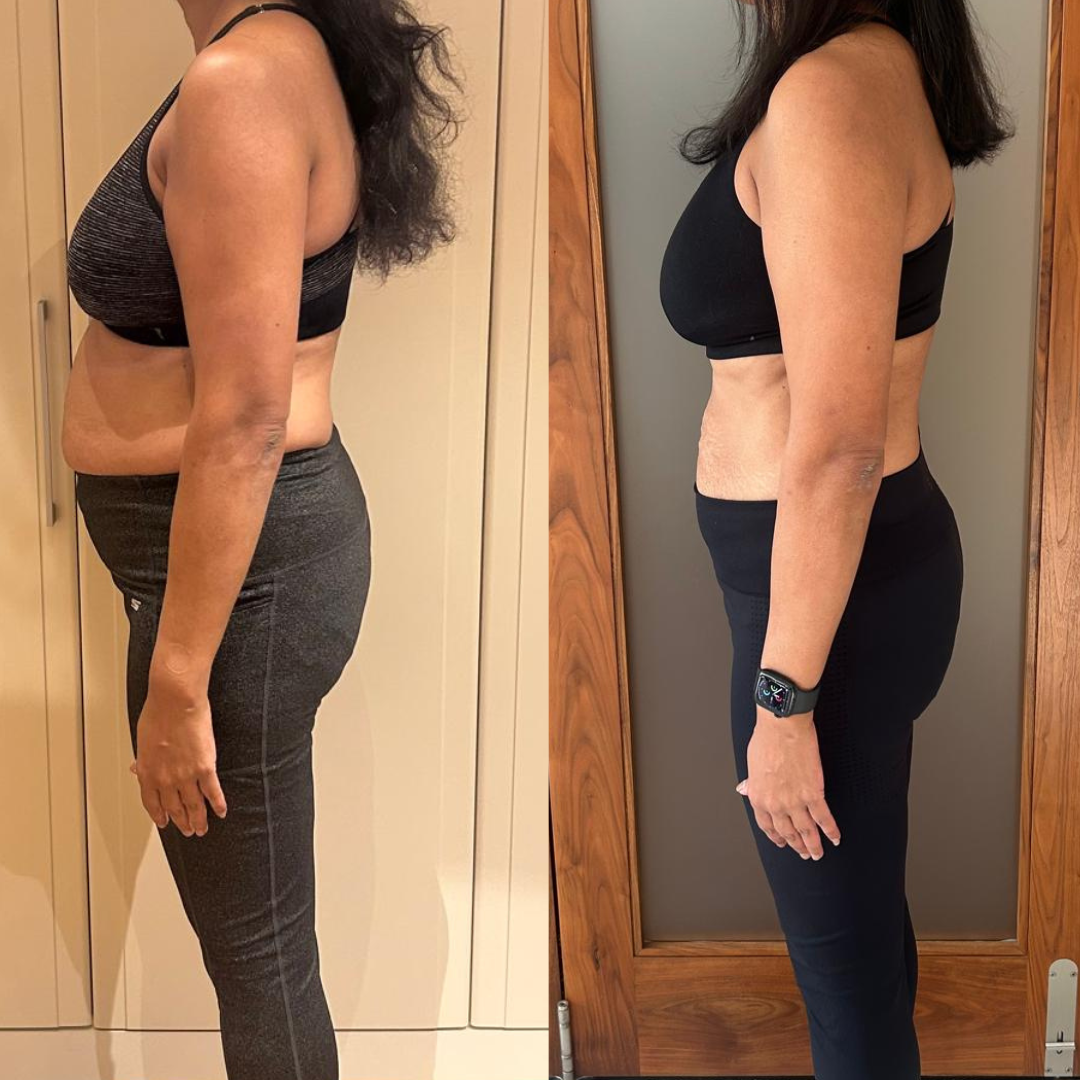 Client transformation image back view