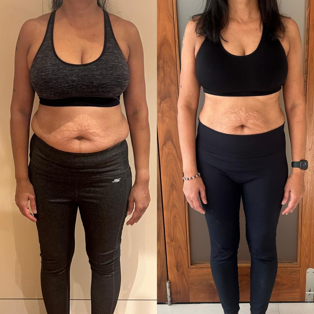 Client transformation image front view
