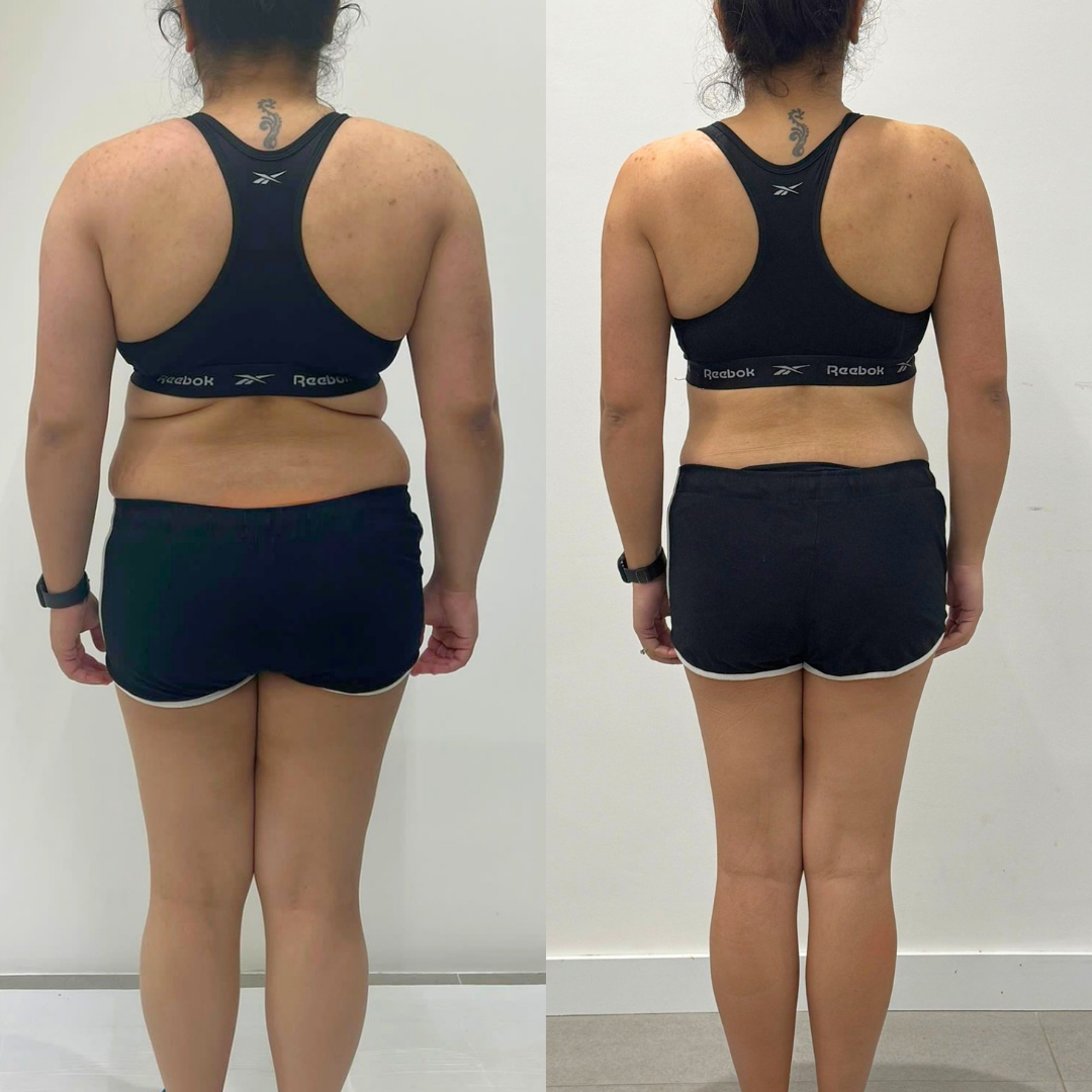 Client transformation image back view