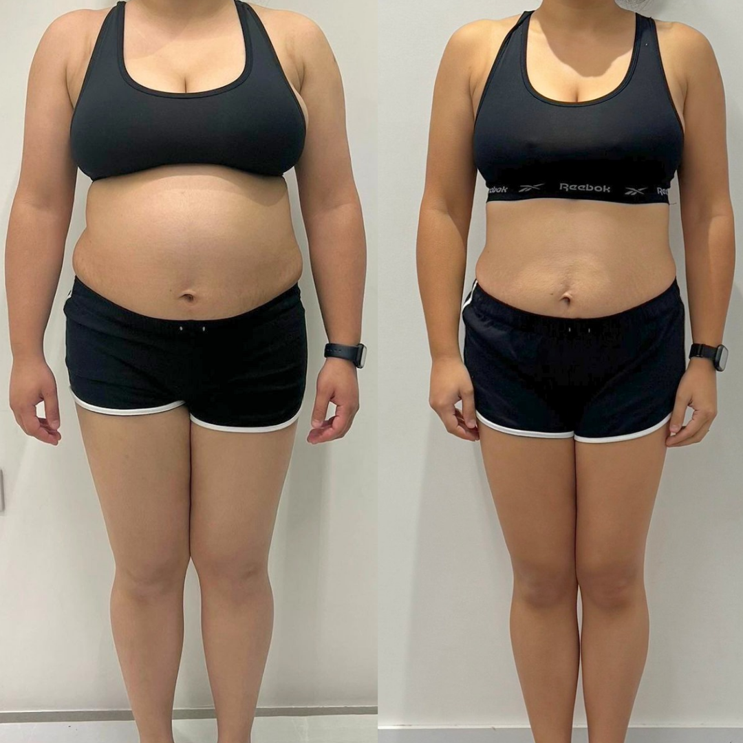 Client transformation image front view